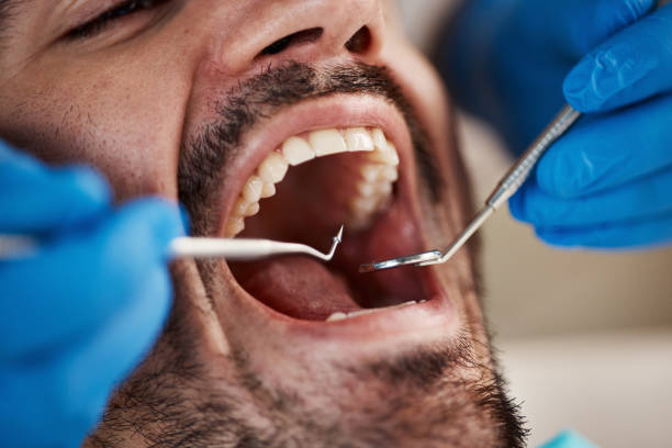 Best Emergency Denture Repair in La Villa, TX